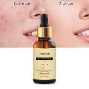 Private Label Organic Herbal Treatment Face Anti Acne Pore Shrinking Salicylic Acid Tea Tree Serum For Pimples