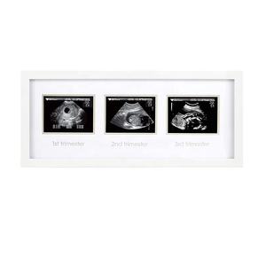 Cadre photo noir et blanc à ultrasons personnalisé pour bébé, idée cadeau de fête prénatale - Product Image 3