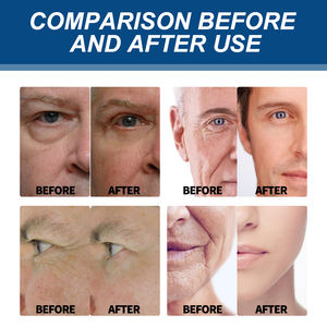 Crema Facial para el Cuidado de la Piel al por Mayor, Marca Privada East Moon, Vitamina E y Retinol, Crema Facial Hidratante Profunda para Hombres, Crema de Noche - Product Image 4