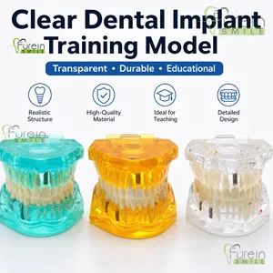 Modelo de Restauración Dental con Dientes Removibles, Implante, Corona y Puente, para Demostración y Estudio, para Educación y Entrenamiento de Dentistas - Product Image 5