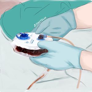 Penyedot pegas PVC, kit sistem drainase luka tertutup, waduk drainase penyedot - Product Image 2