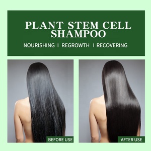 Champú Profesional de Marca Blanca <span class=keywords><strong>con</strong></span> Células <span class=keywords><strong>Madre</strong></span> Vegetales para Nutrir, Suavizar y Estimular el Crecimiento del Cabello - Product Image 3