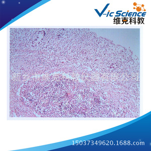 Typhoid fever, medical histology, digestive system diseases, animal and plant slides, <b>microscope</b> use. - Product Image 5