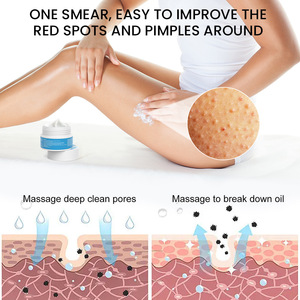 Best seller Sumifun pelle d'oca crema massaggio esfoliante riduzione della pelle di pollo e levigatura della pelle del corpo macchie sbiancanti OEM ODM - Product Image 5