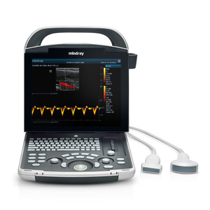 Sistema <span class=keywords><strong>de</strong></span> Diagnóstico por <span class=keywords><strong>Ultrasonido</strong></span> Doppler Color Digital Portátil Mindray DP-30 con Imágenes <span class=keywords><strong>de</strong></span> Alta Resolución para Uso Clínico - Product Image 6