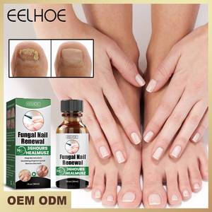 EELHOE Vente en gros OEM 30ML Sérum Renouvellement des Ongles Anti-Fongique Huile Apaisante Nourrissante Réparatrice Traitement des Mycoses des Ongles - Product Image 2