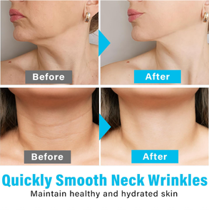 Алидина, новейшая маска для шеи, биколлагеновая маска, биоколлаген, настоящие глубокие выцветшие морщины на шее - Product Image 6