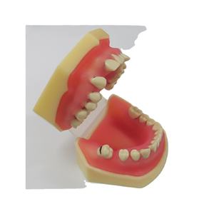 Modelo de enfermedad periodontal dental para educación modelo de diente de ciencia médica - Product Image 2