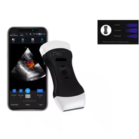 Mesin Ultrasound nirkabel 3-in-1 Portabel USB Wifi Smartphone/Tablet mesin Ultrasound untuk Android IOS Windows