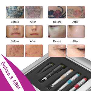 Vẻ đẹp cung cấp qswitch Pico thứ hai Yag laser Loại bỏ hình xăm Pico Laser mạch máu vấn đề da Máy - Product Image 6