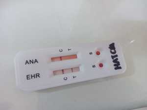 개 에를리히아 항체 복합 아나플라스마 신속 검사 키트 수의 진단 검사 - Product Image 1