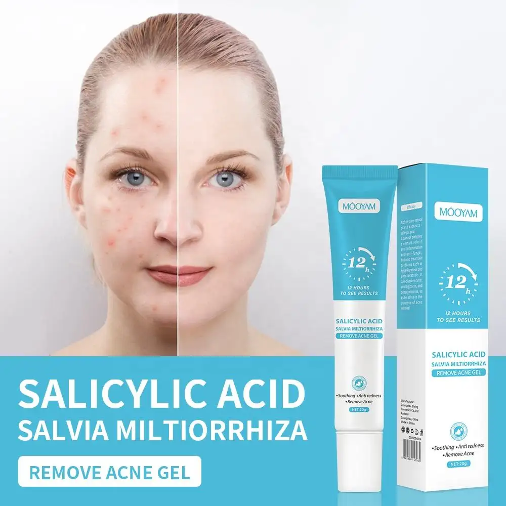 ニキビを起こしやすい肌のためのSalicylic Acid Anti Pimple Acne Treatment Gelを使用したRapid Clear Stubborn Acne Spot Treatment Cream