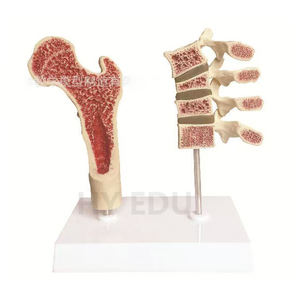 Modello di insegnamento medico di patologia del femore e della colonna vertebrale modello di osteoporosi di vendita a caldo - Product Image 1