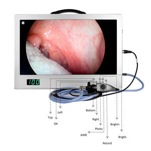 4 इन 1 इंटीग्रेटेड एंडोस्कोप कैमरा सिस्टम ऑल इन वन मेडिकल पोर्टेबल 80w एलईडी कोल्ड लाइट सोर्स एचडी 24 इंच एंडोस्कोप मॉनिटर - Product Image 3