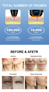 เครื่องนวดหน้า 2-in-1 สำหรับตั้งโต๊ะ ช่วยลดเลือนริ้วรอย ฟื้นฟูผิวอย่างแม่นยำ ยกกระชับใบหน้า ปรับรูปหน้า พร้อมปลั๊กแบบ AU - Product Image 4