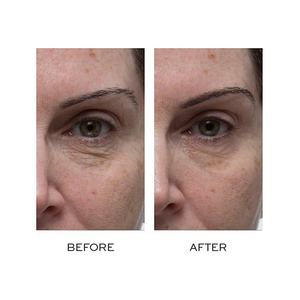 ครีมบำรุงรอบดวงตาลดเลือนริ้วรอย,ครีมบำรุงรอบดวงตาต่อต้านริ้วรอยทองคำ24K - Product Image 5