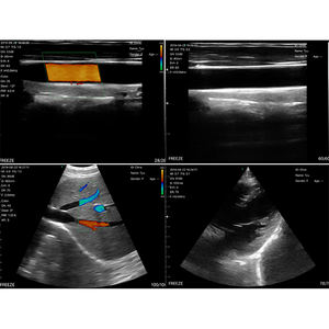 Ultrasonido inalámbrico <span class=keywords><strong>de</strong></span> Color portátil humano <span class=keywords><strong>de</strong></span> mano, sondas <span class=keywords><strong>de</strong></span> escáner, máquina <span class=keywords><strong>de</strong></span> sonda <span class=keywords><strong>de</strong></span> Color 3D 4d para <span class=keywords><strong>PICC</strong></span> - Product Image 6