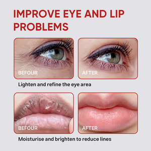 <span class=keywords><strong>Masque</strong></span> pour les yeux et les lèvres en hydrogel à la rose personnalisé OEM pour hydrater, nourrir et lisser les yeux et les lèvres, produits de soin de la peau - Product Image 6