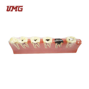 Gesectioneerd Met Pulpziekte Aandoeningen Parodontale Ziekten Classificatiemodel - Product Image 2