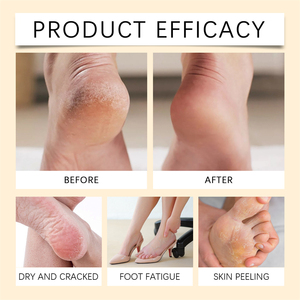 OUHOE - Paquete de Gelatina de Cristal para Spa, Paquete de Sal, Hidratante, Exfoliante, Suavizante, Alivia la Fatiga, Gelatina para Pedicura y Spa de Pies - Product Image 2