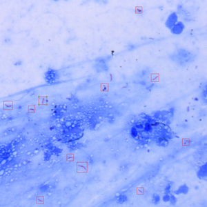 Bestscope Scanpro3-50FL huỳnh quang mycobacterium tuberculosis kính hiển vi quét hệ thống cho giảng dạy hoặc Chẩn Đoán từ xa - Product Image 2