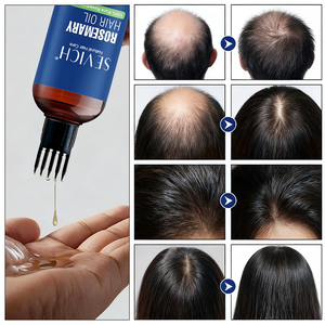 Aceite esencial de romero y jojoba de gran venta, Aceite Esencial Hidratante nutritivo ordinario para el cuidado del <span class=keywords><strong>cabello</strong></span> para el <span class=keywords><strong>crecimiento</strong></span> del <span class=keywords><strong>cabello</strong></span> - Product Image 3