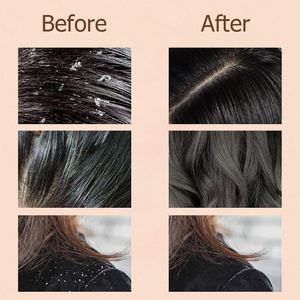 En Stock Champú Fortalecedor y Suavizante con Fragancia, Suave, Brillante, Orgánico, Romero, Menta, Cebolla, Biotina y Aceite de Romero 300ml - Product Image 5