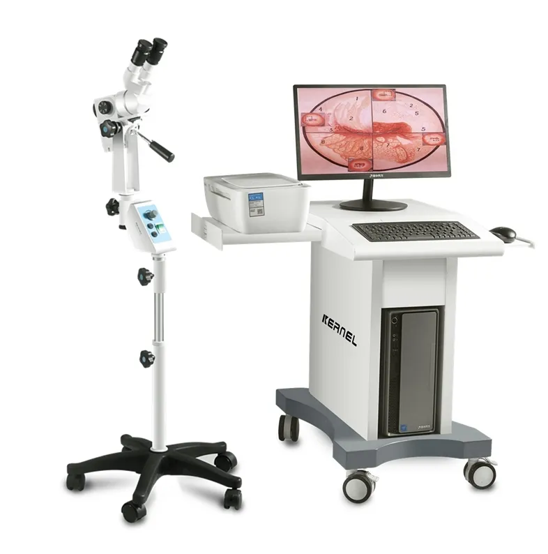 Kernel colposcope médico portátil endoscopio óptico video digital colposcopio cámara para Ginecología