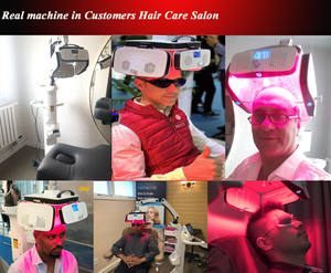 Système de repousse des cheveux au laser à diode OEM 650nm 424 Diodes équipement professionnel de thérapie capillaire au laser pour les cliniques - Product Image 4