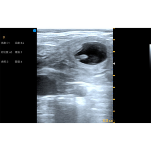 Sonda Rettale <span class=keywords><strong>BMV</strong></span> S7 PRO per Ecografia Veterinaria, Scanner Portatile Cablato per Diagnosi di Gravidanza in Bestiame e Cavalli - Product Image 6