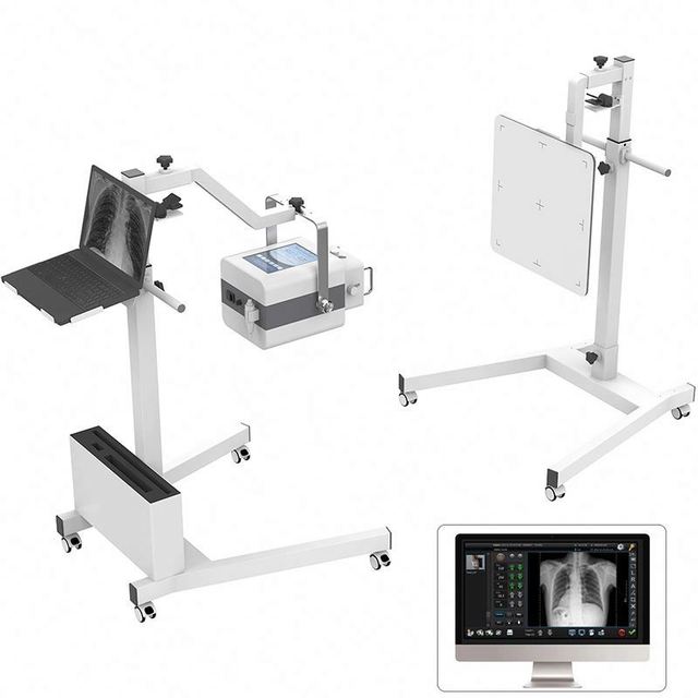 Medical Digital Radiology Equipment 9.7 Inch Touch Screen 5.0KW Portable High Frequency X Ray Machine Price for Human or Vet