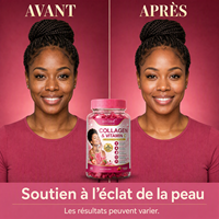 BIYODE Afrique Très Populaire Gommes Collagène & Vitamine C Complément Bien-être En Stock Faible MOQ Vente en Gros Direct Usine