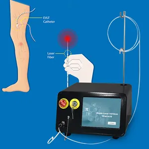 Triangelaser kép 980nm 1470nm evla endovenous tĩnh mạch laser cắt bỏ giãn tĩnh mạch Spider tĩnh mạch loại bỏ cho phòng khám