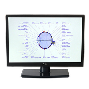 จอภาพตรวจวัดสายตา Guangdong Vision Chart ขนาด 21.5 นิ้ว LCD พร้อมรีโมทคอนโทรล - Product Image 2