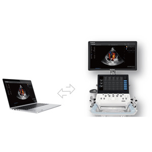 Solución de Ultrasonido de Diagnóstico Veterinario Económica de Nivel Básico Sonoscape ProPet 60 - Product Image 1