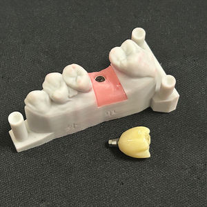 Prothèses dentaires d'implant matériel de marque internationale couronnes de prothèses dentaires d'implant pour des soins dentaires - Product Image 6