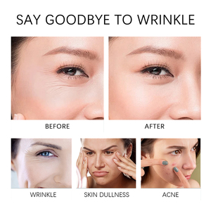 Crème Hydratante et Éclaircissante Anti-rides à la Bave d'Escargot en Gros – Atténue les Imperfections, Réduit les Rides Fines et les Pores – Crème à la Mucine d'Escargot - Product Image 6