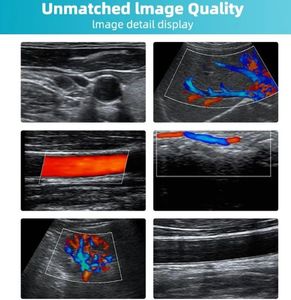 Ecógrafo Veterinario Portátil, Escáner de Ultrasonido de Mano para Gestación de Mascotas e Imágenes de Ganado - Product Image 6