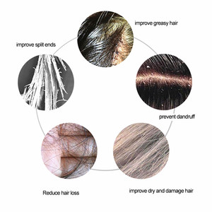 Manufacturer Price Blood Circulated <strong>Hair</strong> Vibrating <strong>Scalp</strong> <strong>Massager</strong> Laser Comb <strong>for</strong> <strong>Hair</strong> Growth - Product Image 5