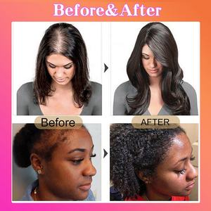 Huile de Batana 100% Naturelle et Biologique pour Soins Capillaires : Nourrit, Lisse et Favorise la Croissance des Cheveux, Inoffensive pour le Cuir Chevelu (Vente en Gros) - Product Image 6