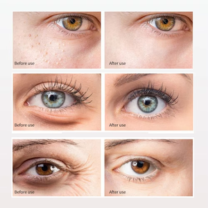 Masque pour les yeux en silicone réutilisable, <span class=keywords><strong>patch</strong></span> à la vitamine E, <span class=keywords><strong>anti</strong></span>-rides, <span class=keywords><strong>anti</strong></span>-âge, sans parfum, réduit les poches sous les yeux, les <span class=keywords><strong>cernes</strong></span> - Product Image 3