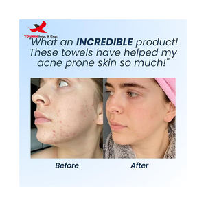 กระดาษเช็ดหน้า OEM เนื้อนุ่มพิเศษ สำหรับผู้ใหญ่ ทำความสะอาดประจำวัน คุณภาพสูง พิมพ์ลายตามสั่ง กระดาษเช็ดหน้าเนื้อฝ้าย ผ้าเช็ดหน้า - Product Image 6