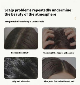 Sampo perawatan ketombe Label pribadi 250ml sampo Selenium sulfida untuk <span class=keywords><strong>Psoriasis</strong></span> dan jamur Malassezia - Product Image 5