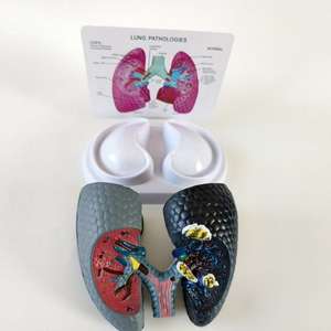 Modelo Anatómico Patológico de Corazón y Pulmón Humano con Imágenes - Medicina - Modelo del Sistema Respiratorio Pulmonar - Product Image 6