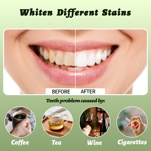 <span class=keywords><strong>Pasta</strong></span> <span class=keywords><strong>Dental</strong></span> de Carbón Vegetal al por Mayor 100g con Menta Refrescante, Limpieza Profunda y Blanqueamiento <span class=keywords><strong>Dental</strong></span>, la Más Vendida en Latinoamérica - Product Image 4