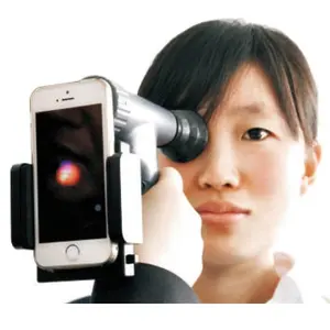 Офтальмоскопический фотоаппарат