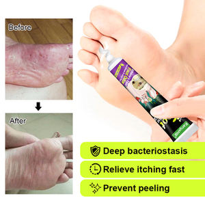 Gel pour pieds KanyeHB, tinea pedis, à base de plantes, antifongique, pour soulager les démangeaisons, les pieds qui pèlent et l'élimination des odeurs, 20g, utilisation sûre - Product Image 4