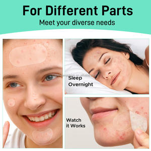 Tambalan jerawat hidrokoloid dengan asam salisilat untuk wajah semua jenis kulit-label pribadi bentuk bulat Patch penyembuhan jerawat - Product Image 3