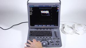 Sonoscape S8 Exp Draagbare Kleur Doppler Echografie Voor Veterinaire Dieren Handheld Veterinaire Echografie Machine - Product Image 2