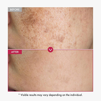 Sérum Éclaircissant Visage 30ml Anti-Taches et Anti-Rousseurs Soin Vitamine C Collagène Céramide Centella OEM Marque Privée
